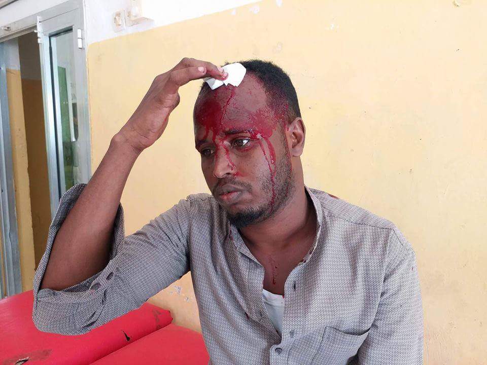 Somali journalist injured in Galkacyo town