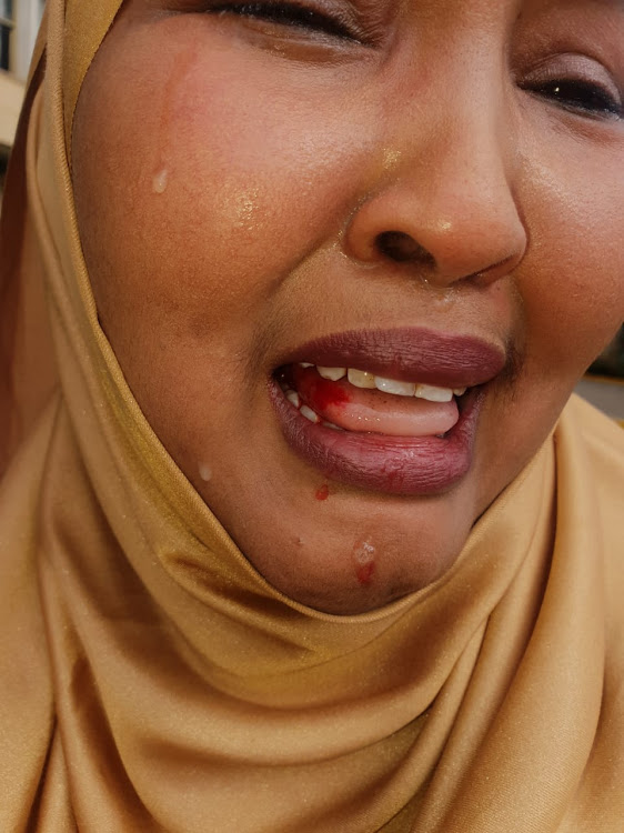 Xildhibaan Rashiid Amiin oo jir dilay xildhibaan Faaduma Geedi + Sawirro