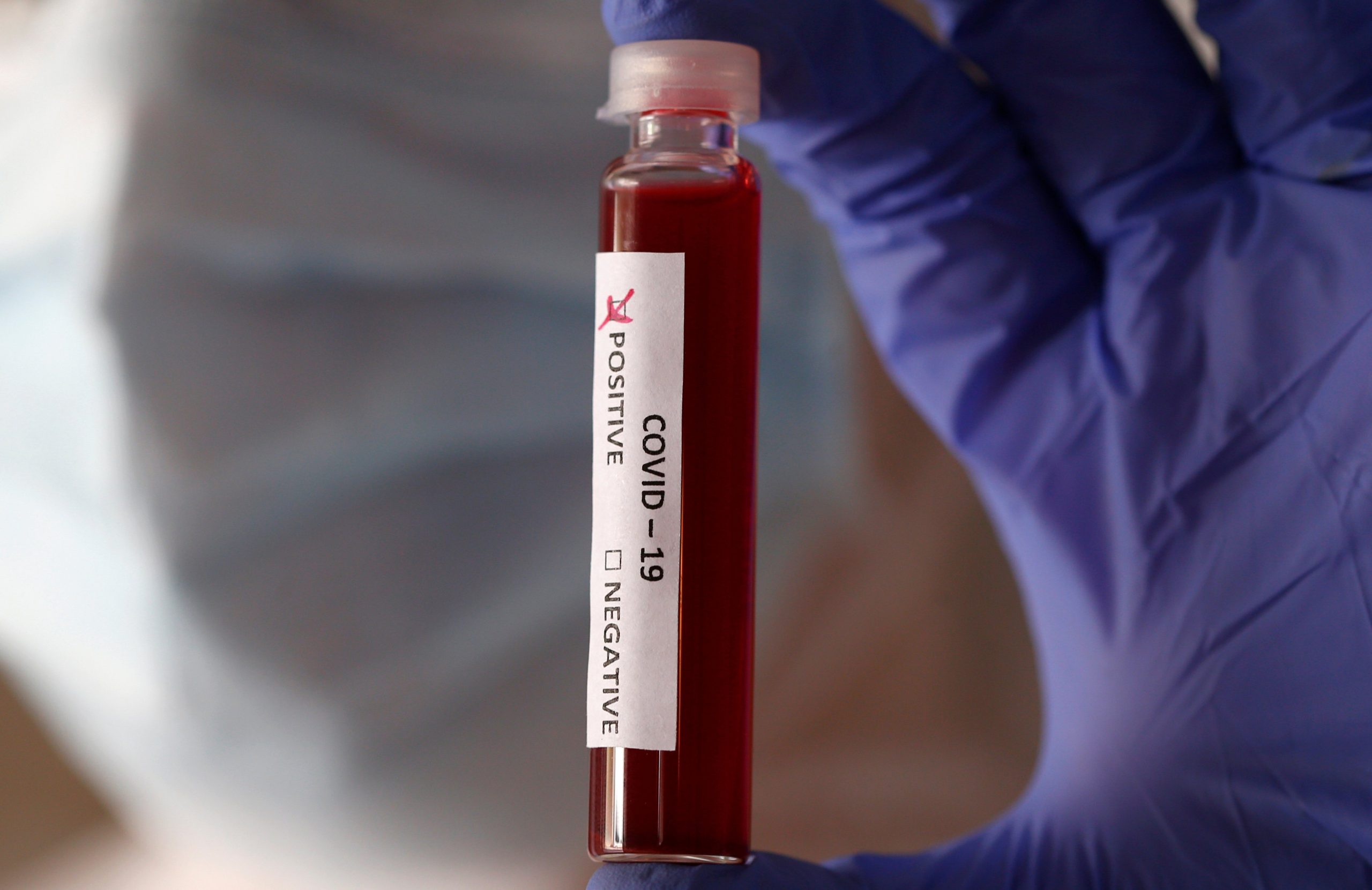 Maxaa ka jira in degaanada Somaliland laga helay kiis la xiriira cudurka Coronavirus?
