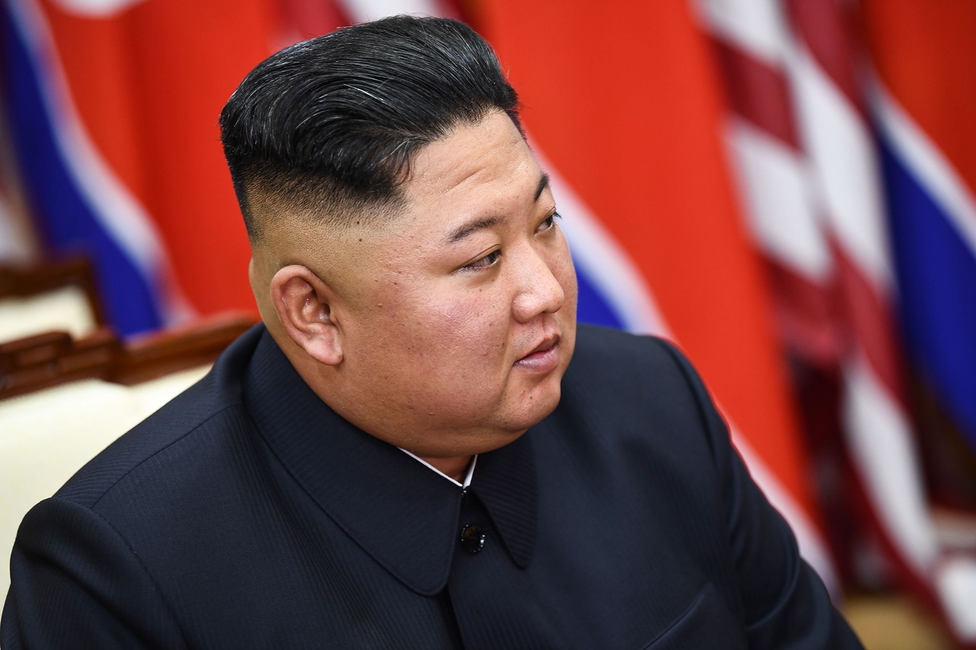 Dhaqtar soo arkay Kim Jong Un oo XOG xasaasi ah ka bixiyey xaaladiisa caafimaad